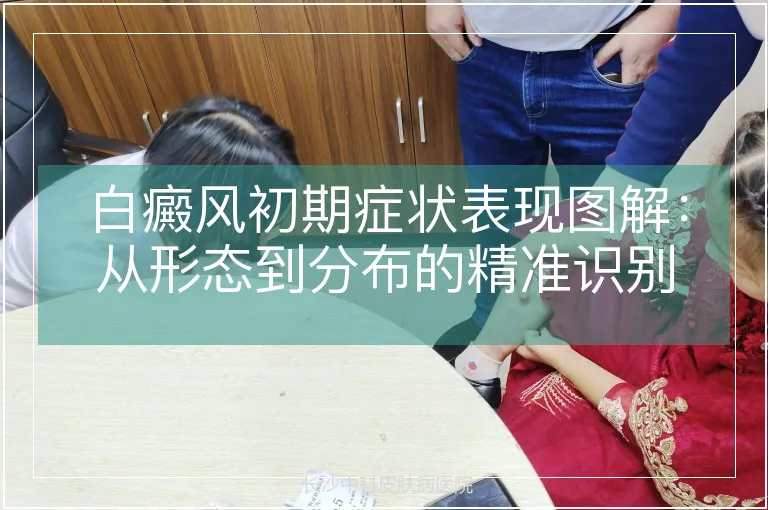 白癜风初期症状表现图解：从形态到分布的精准识别