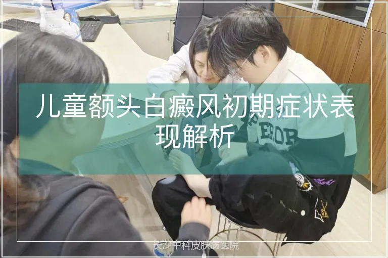 儿童额头白癜风初期症状表现解析