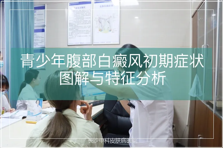 青少年腹部白癜风初期症状图解与特征分析