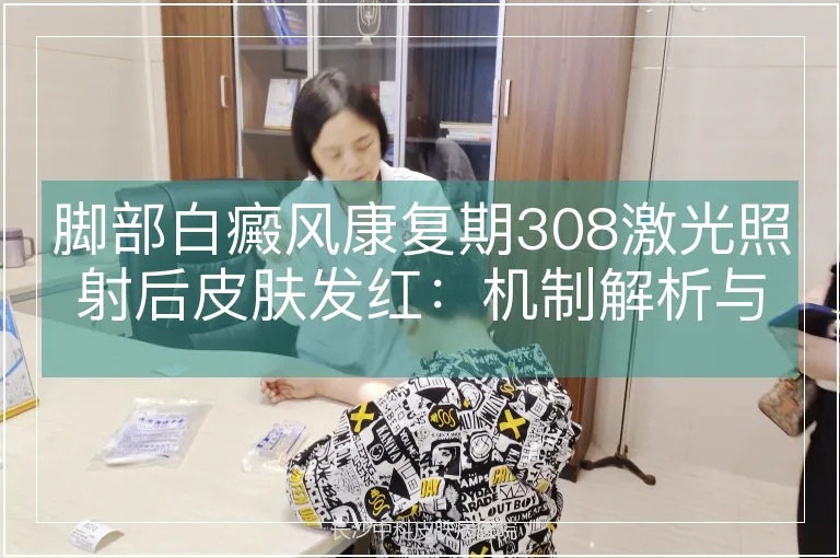 脚部白癜风康复期308激光照射后皮肤发红：机制解析与临床意义