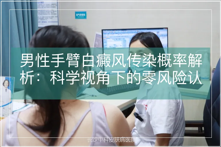 男性手臂白癜风传染概率解析：科学视角下的零风险认知