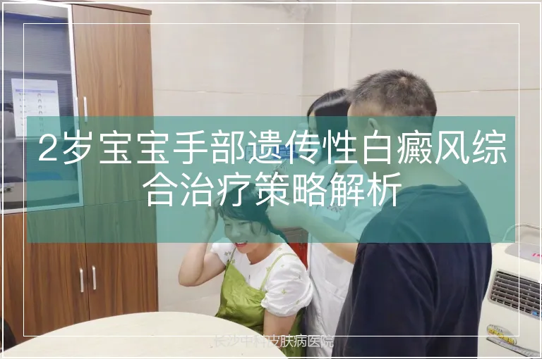 2岁宝宝手部遗传性白癜风综合治疗策略解析
