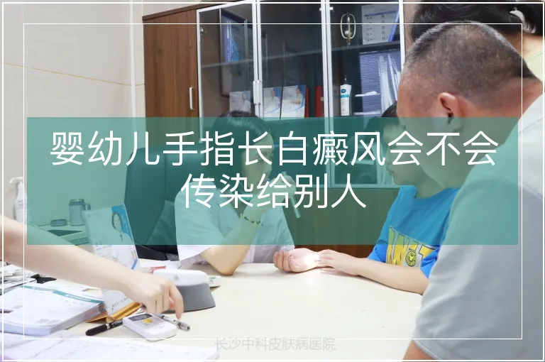 婴幼儿手指长白癜风会不会传染给别人