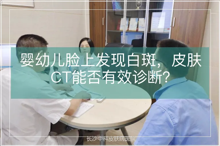 婴幼儿脸上发现白斑，皮肤CT能否有效诊断？