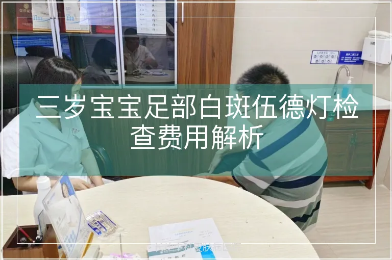三岁宝宝足部白斑伍德灯检查费用解析