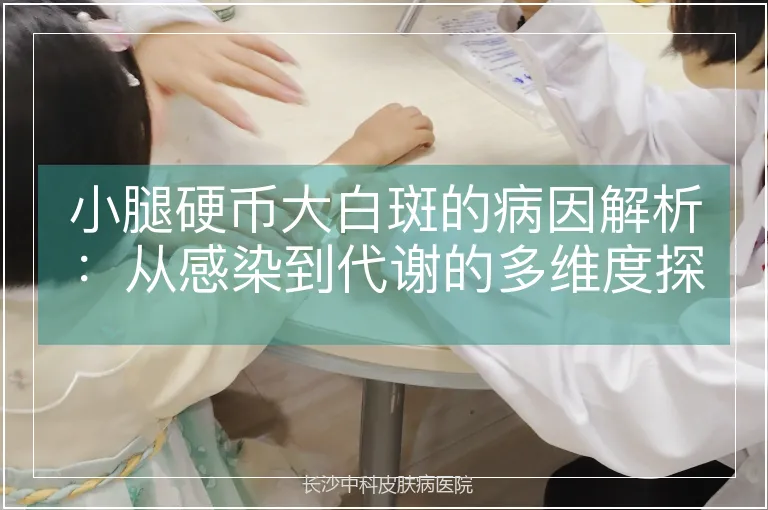 小腿硬币大白斑的病因解析：从感染到代谢的多维度探究