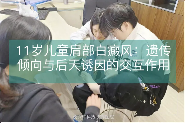 11岁儿童肩部白癜风：遗传倾向与后天诱因的交互作用解析