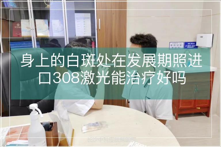 身上的白斑处在发展期照进口308激光能治疗好吗