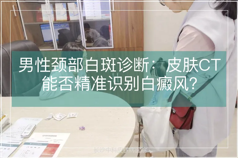 男性颈部白斑诊断：皮肤CT能否精准识别白癜风？