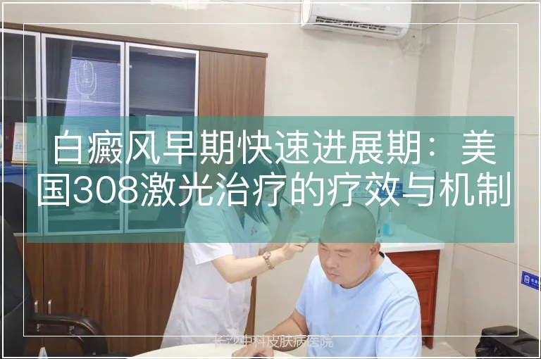 白癜风早期快速进展期：美国308激光治疗的疗效与机制解析