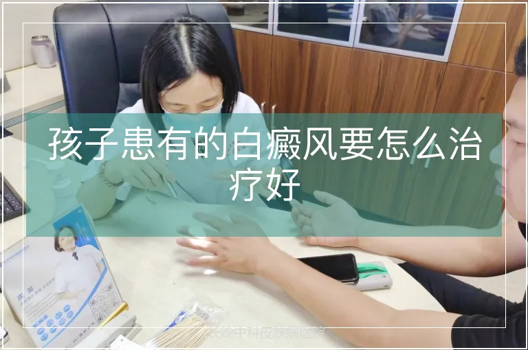 孩子患有的白癜风要怎么治疗好