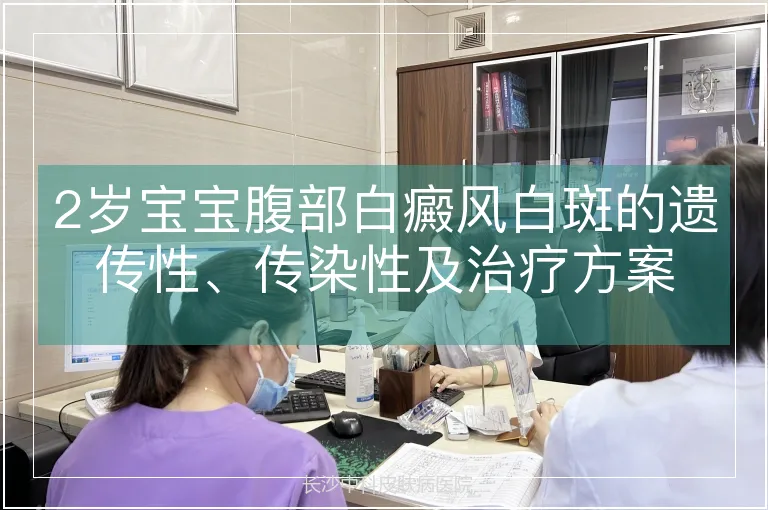 2岁宝宝腹部白癜风白斑的遗传性、传染性及治疗方案