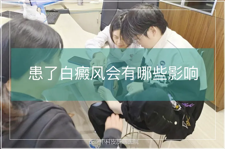 患了白癜风会有哪些影响