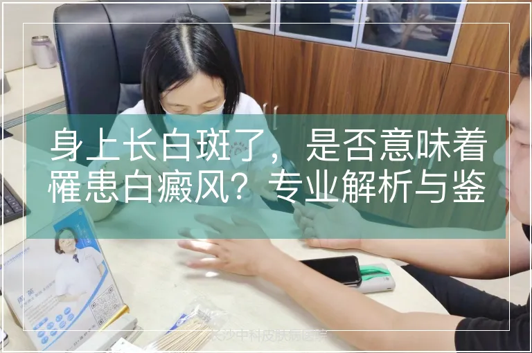 身上长白斑了，是否意味着罹患白癜风？专业解析与鉴别要点