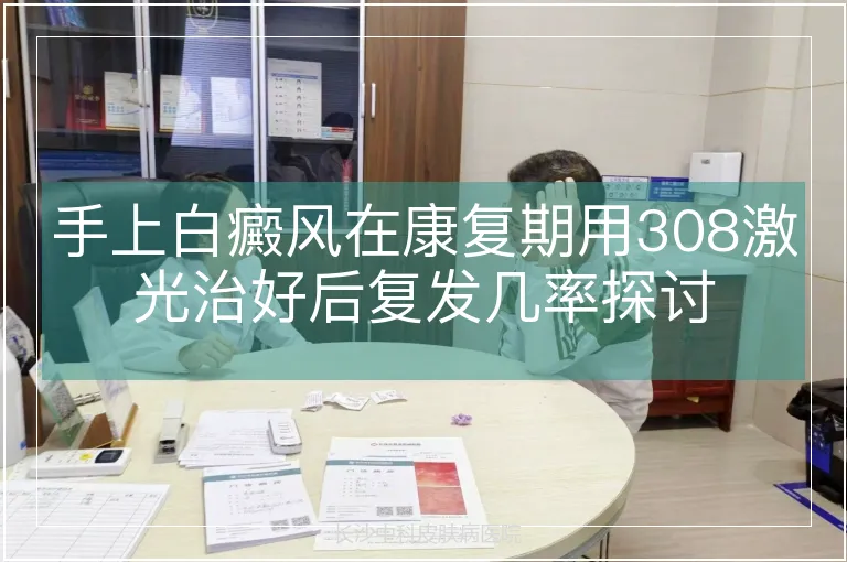 手上白癜风在康复期用308激光治好后复发几率探讨