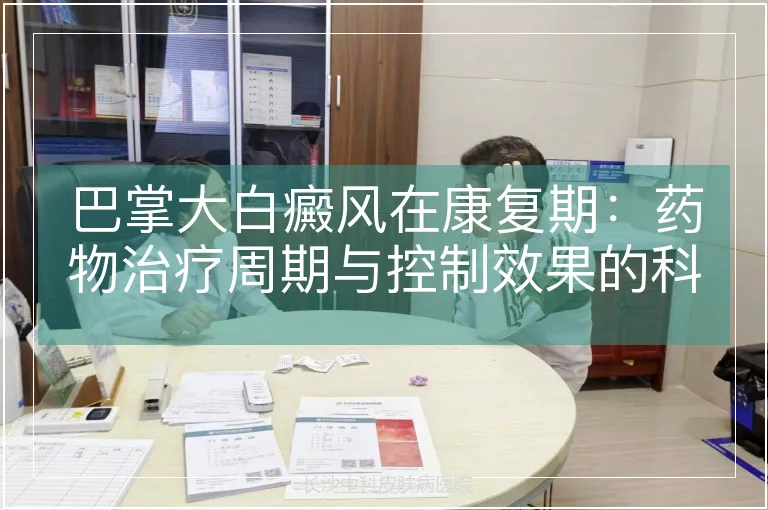 巴掌大白癜风在康复期：药物治疗周期与控制效果的科学解析