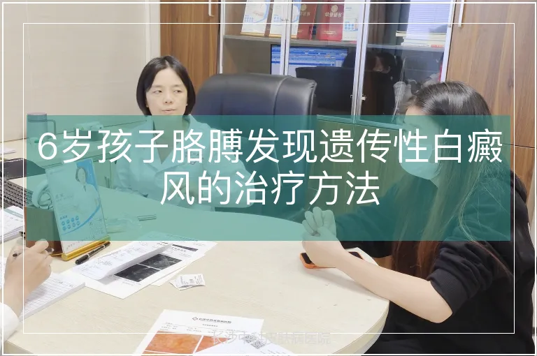 6岁孩子胳膊发现遗传性白癜风的治疗方法