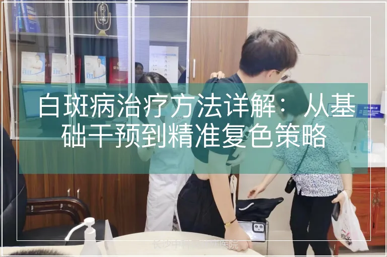白斑病治疗方法详解：从基础干预到精准复色策略