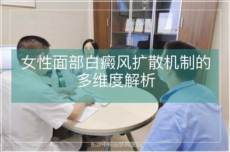 女性面部白癜风扩散机制的多维度解析