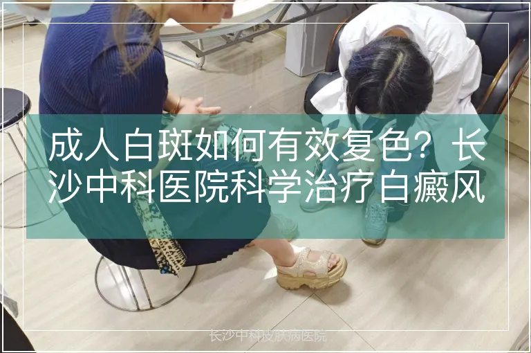 成人白斑如何有效复色？长沙中科医院科学治疗白癜风